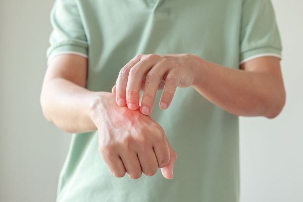 Prírodný prípravok na bodnutie hmyzom